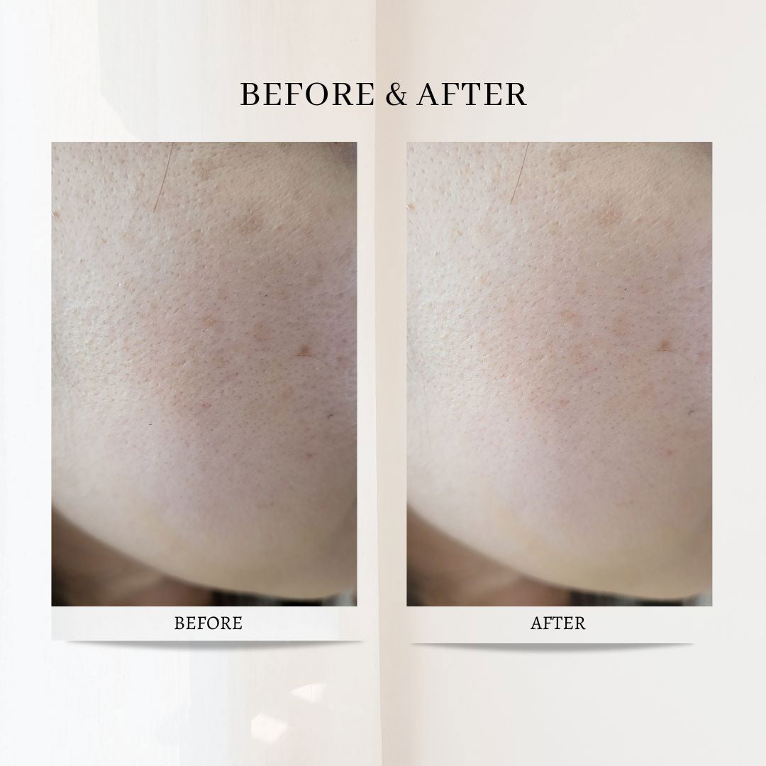 Beauty Factory Retinol Collagen Boosting Serum - Miessential