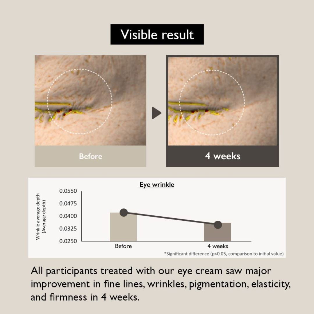 HARUHARU WONDER Black Rice Bakuchiol Eye Cream - Miessential