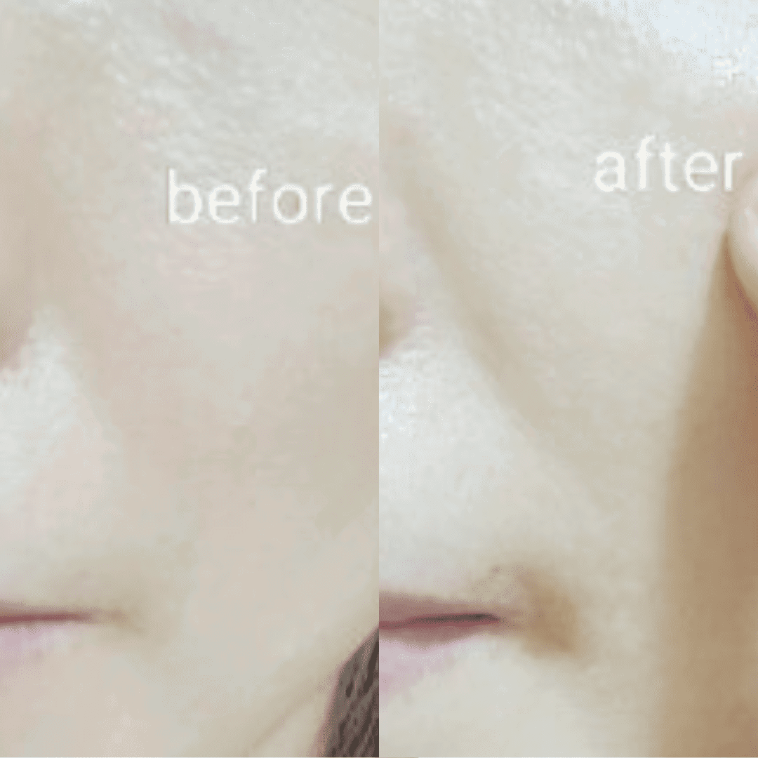 Ja Yeon Mapping Collagen Anti-Aging Mask (5 PCS) - Miessential