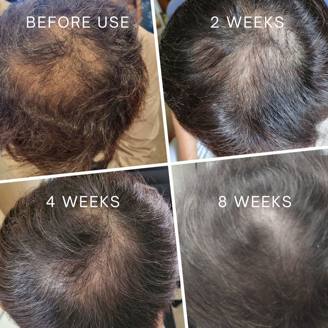 La Verne Lumiere 5α-Avocuta T Strengthening Conditioner - Miessential