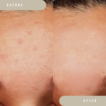 Beauty Factory Chamomile PDRN Regenerating Toner