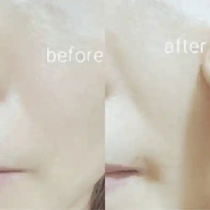 Ja Yeon Mapping Yellow Ochre Anti-Inflammatory Mask (5 PCS) - Miessential