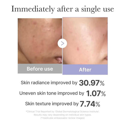 Medicube Age-R Booster Pro Mini