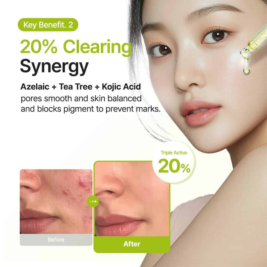 Purito Azelaic Acid 10 Kojic Tea Tree Serum