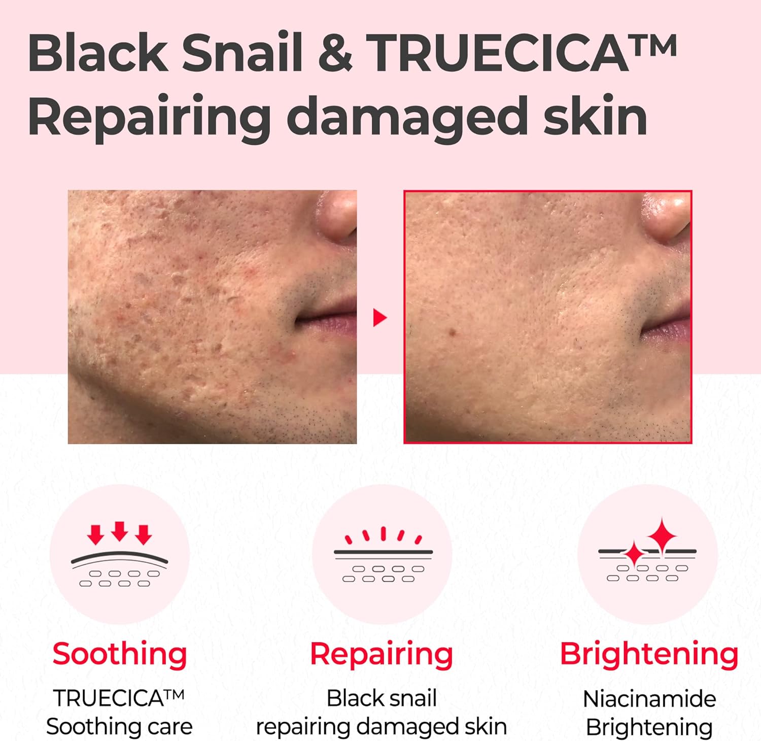 SOME BY MI Snail Truecica Miracle Repair Toner SOME BY MI